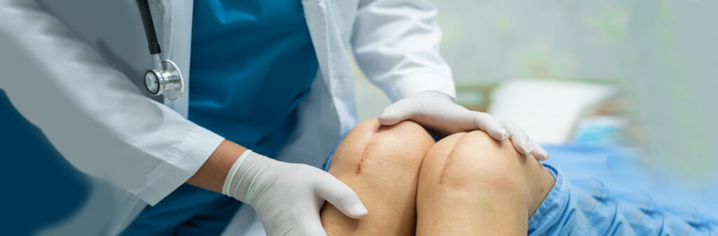 best knee replacement surgeon in Chandigarh