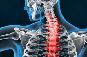 spine specialist in zirakpur