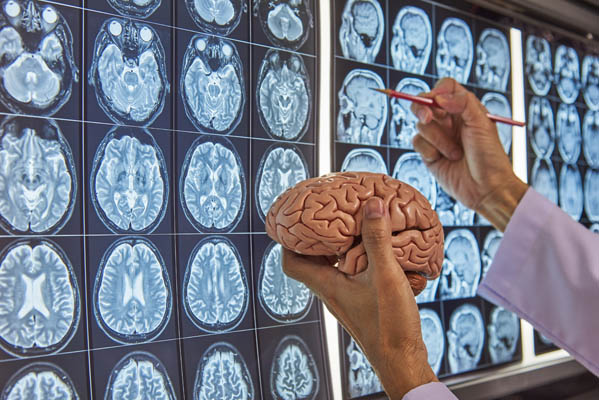 Neurosurgeon in Chandigarh