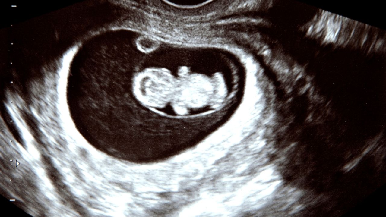 How Does Hypertension Affect the Baby in Pregnancy