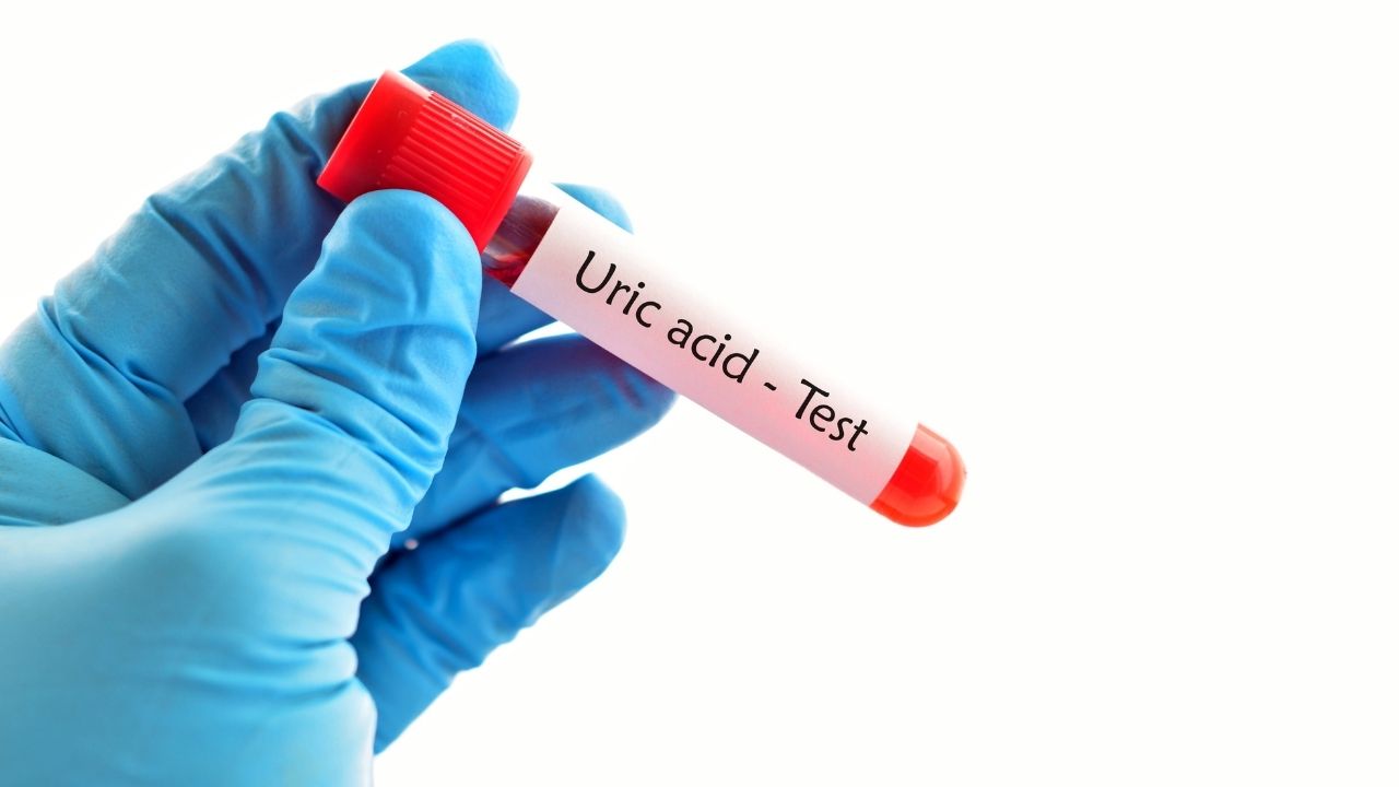 What are the Symptoms of High Uric Acid in the Body