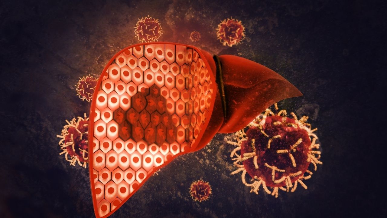 What Is Liver Cancer