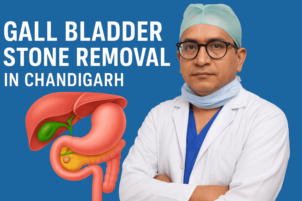 Gall Bladder Stone Removal In Chandigarh