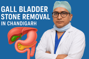 Gall Bladder Stone Removal In Chandigarh