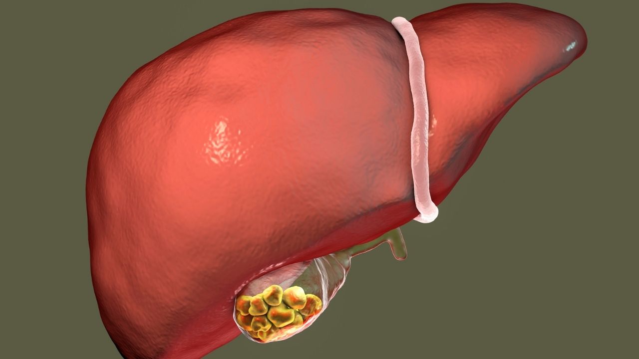 How Gall Bladder Stones Are Removed