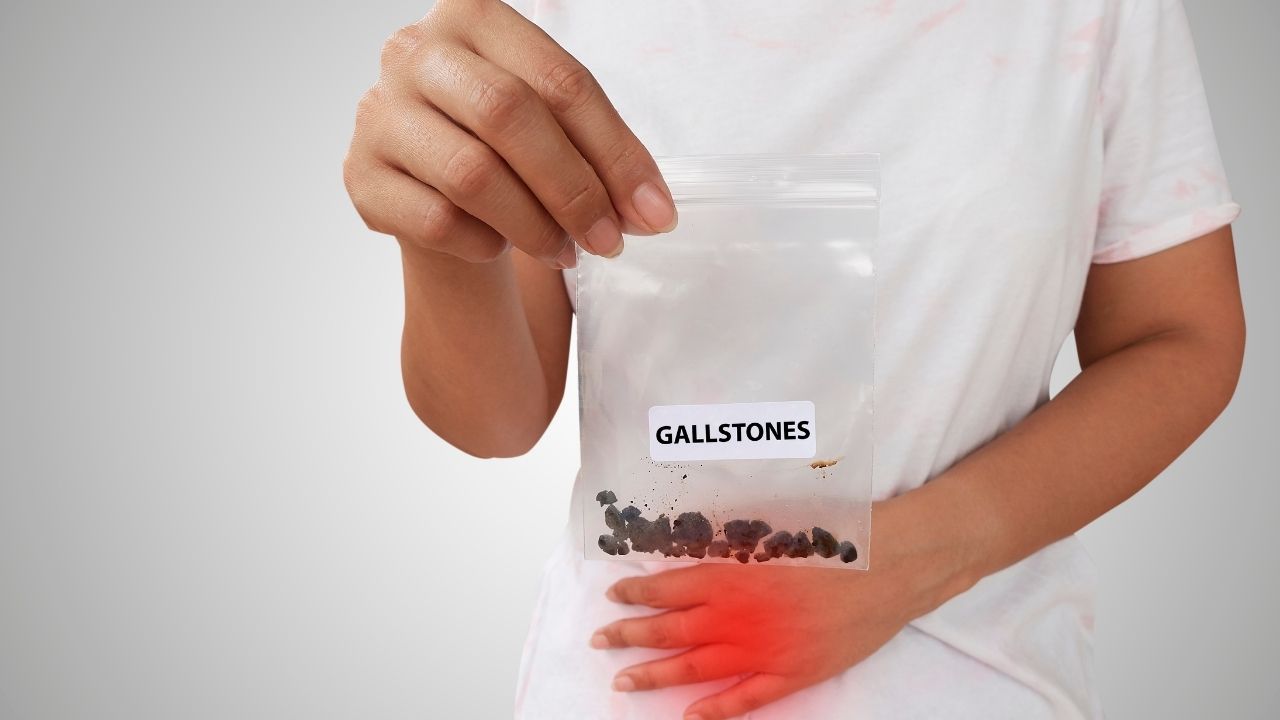 Procedure to remove gall stones